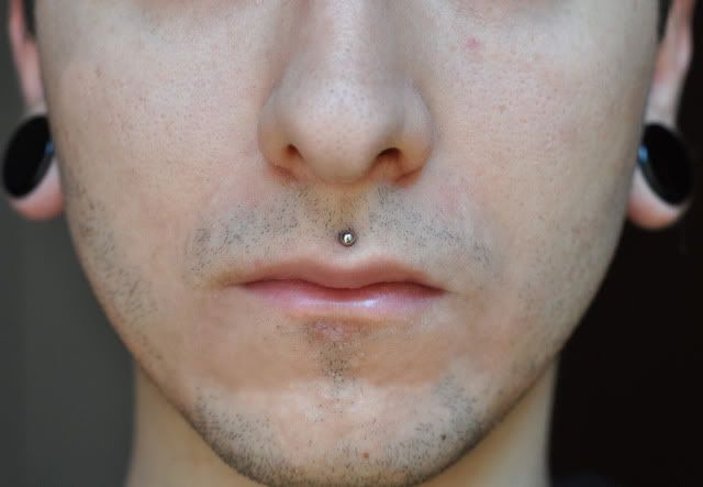 Scalpelled Labret