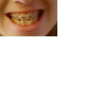 teeth1.jpg