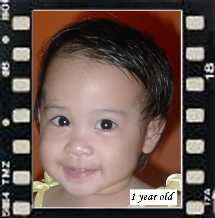 age 1 year