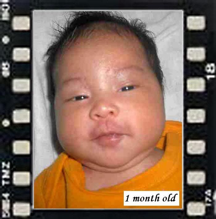age 1 months
